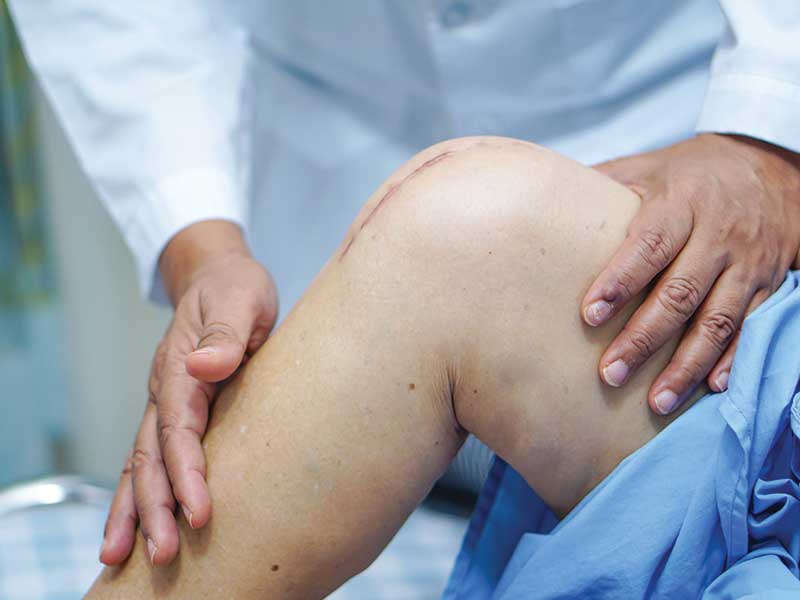 Partial Knee Replacement Surgery