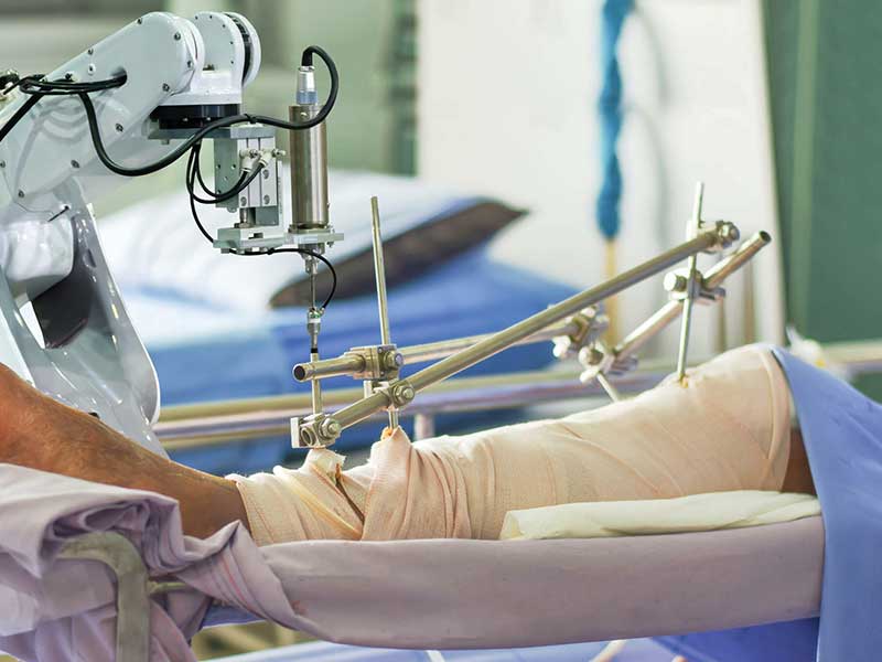 Partial Knee Replacement Surgery